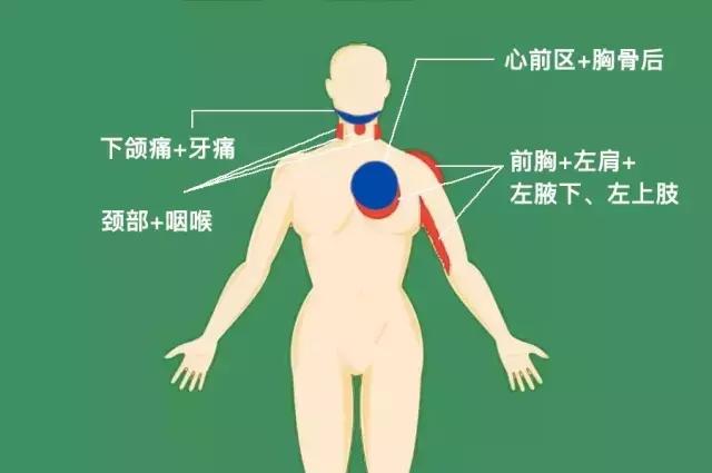 这9处疼痛竟能瞬间吞噬生命！黄金60分这样做能救命~（收藏）