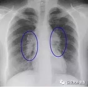 肿瘤科主任：守好19条防癌“军规”，守住一辈子的健康~