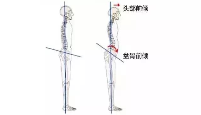 这5个姿势常做毁健康！再不纠正就要“长残”了……