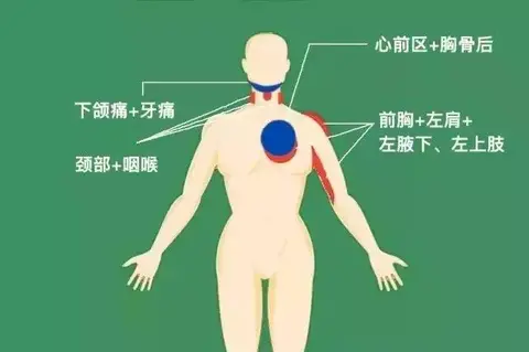 这9处疼痛可能吞噬生命！“急救4步”能救命！10招助力保护心脏！