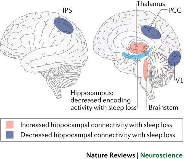 睡眠剥夺下的人类大脑