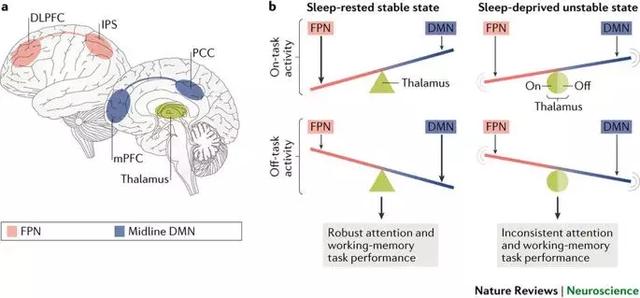 睡眠剥夺下的人类大脑